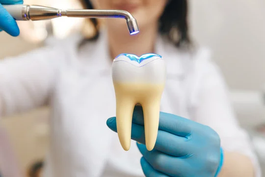 Who Needs Dental Fillings?